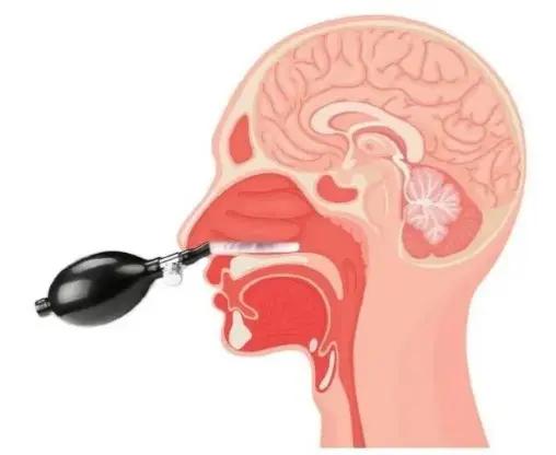 Chiropractic Portland OR Cranial Facial Release 1