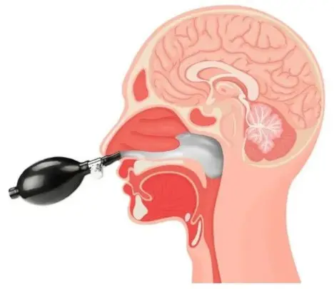 Chiropractic Portland OR Cranial Facial Release 2